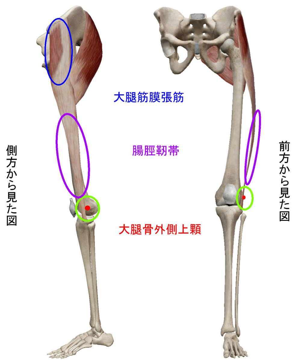 腸脛靭帯炎って何？？ | 美作市スポーツ医療看護専門学校